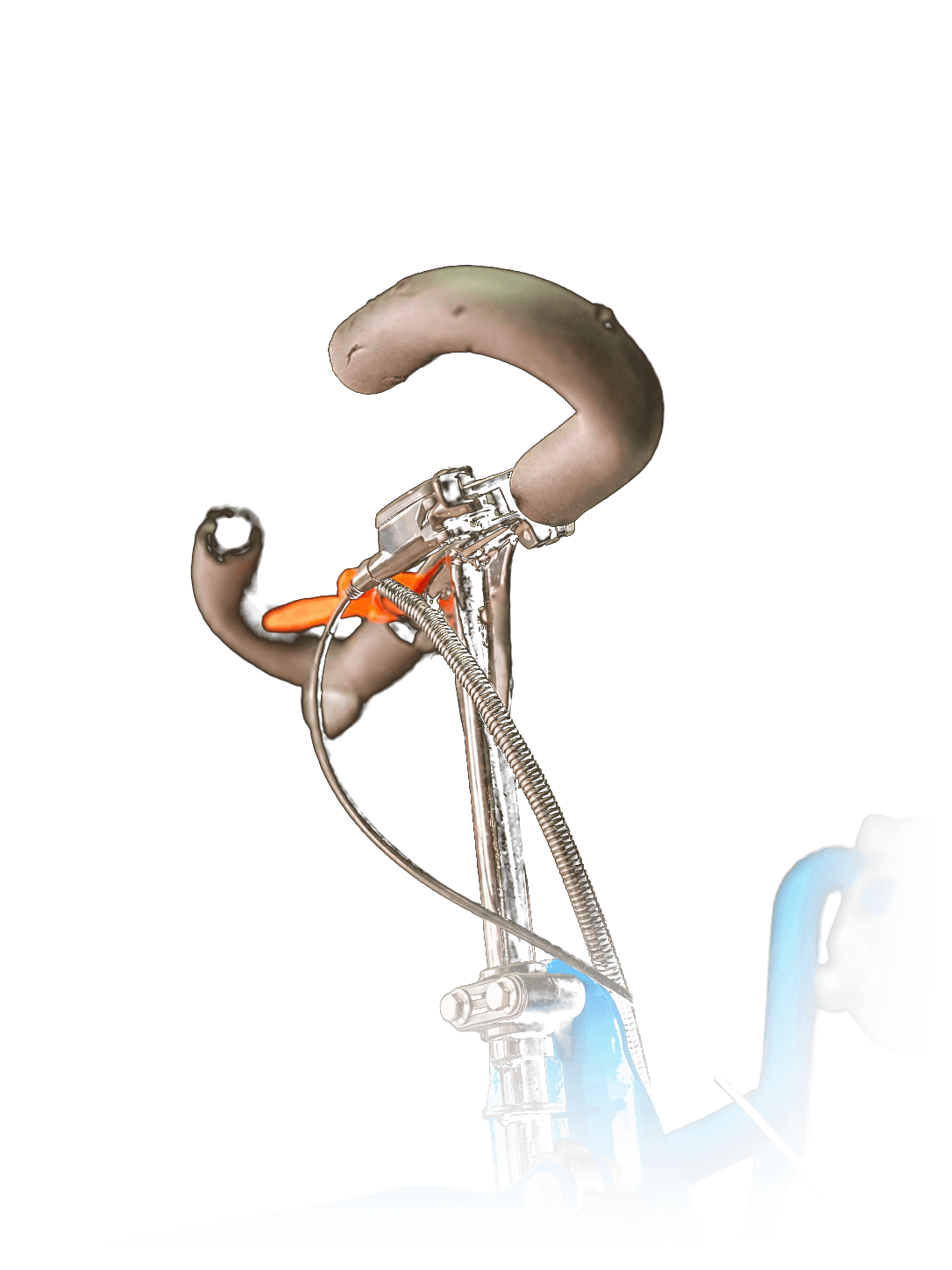 Kart Vlak, ángulo 6